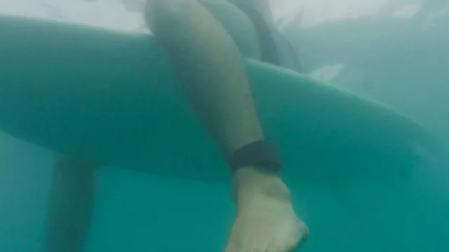 Sharkbanz, el brazalete que repele las mordidas de tiburones